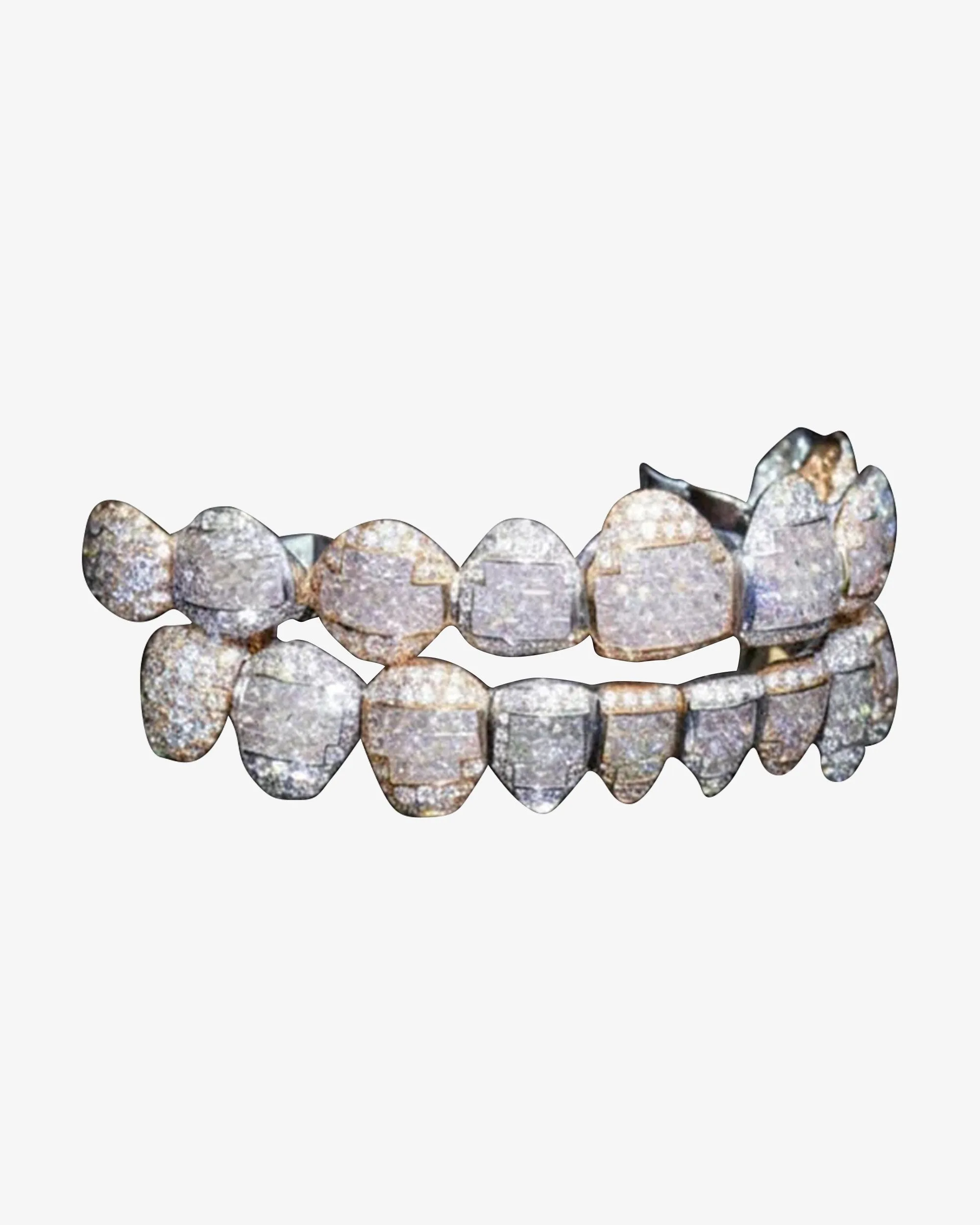 10 on 10 VVS Moissanite Diamond Grillz - in white gold (view 3 of 5)