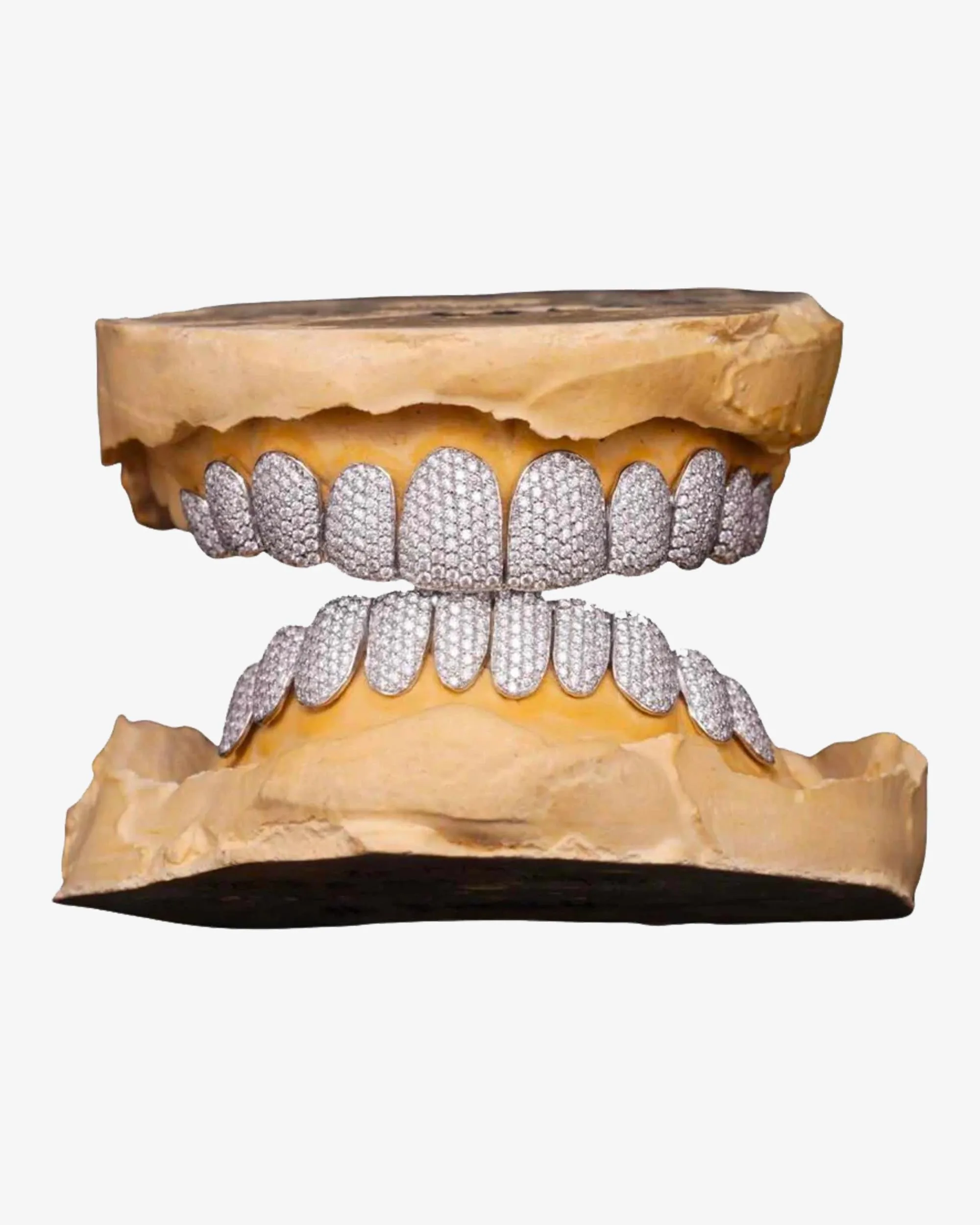 10 on 10 VVS Moissanite Prong Diamond Grillz - in white gold (view 4 of 24)