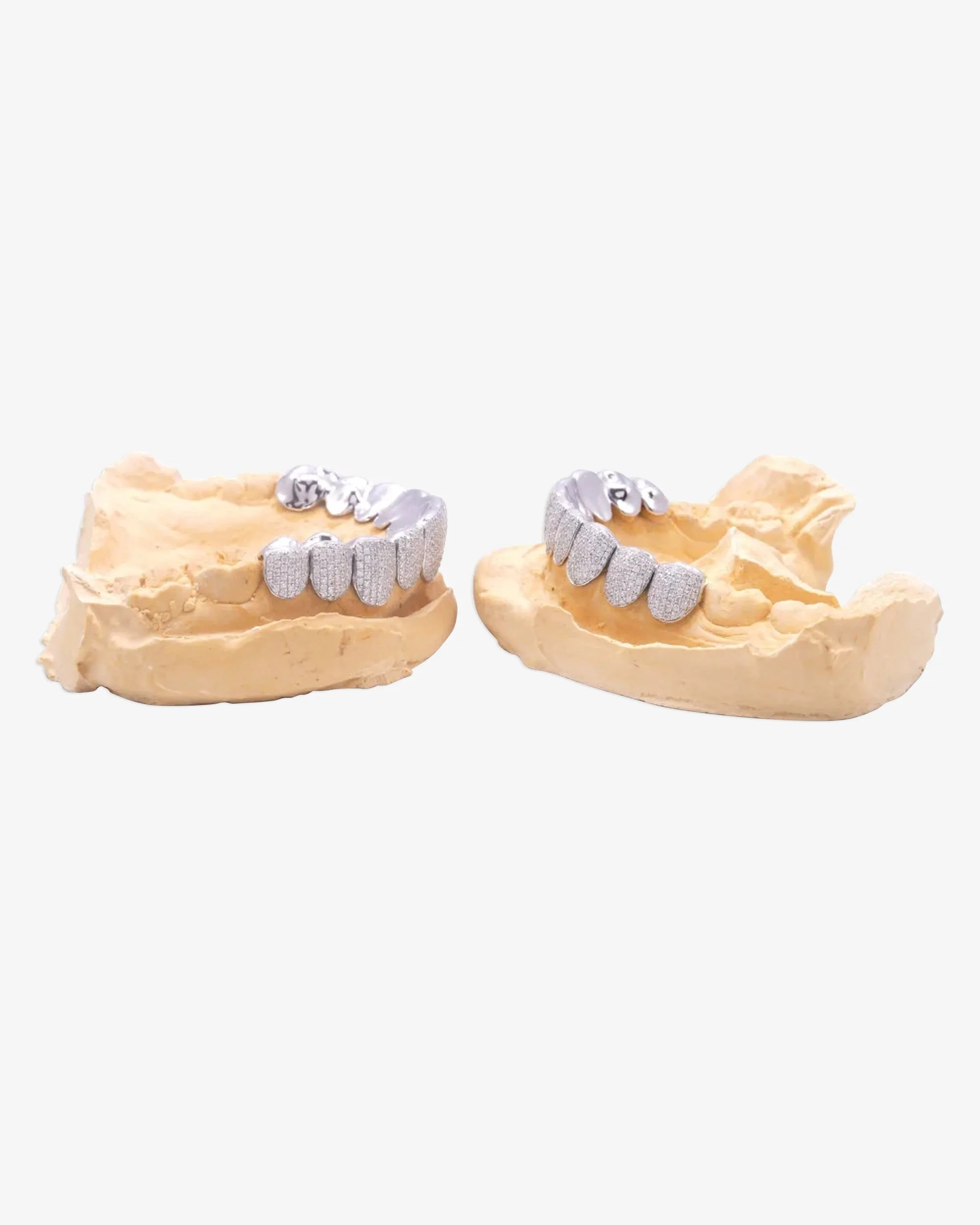 10 on 10 VVS Moissanite Prong Diamond Grillz - in white gold (view 5 of 24)