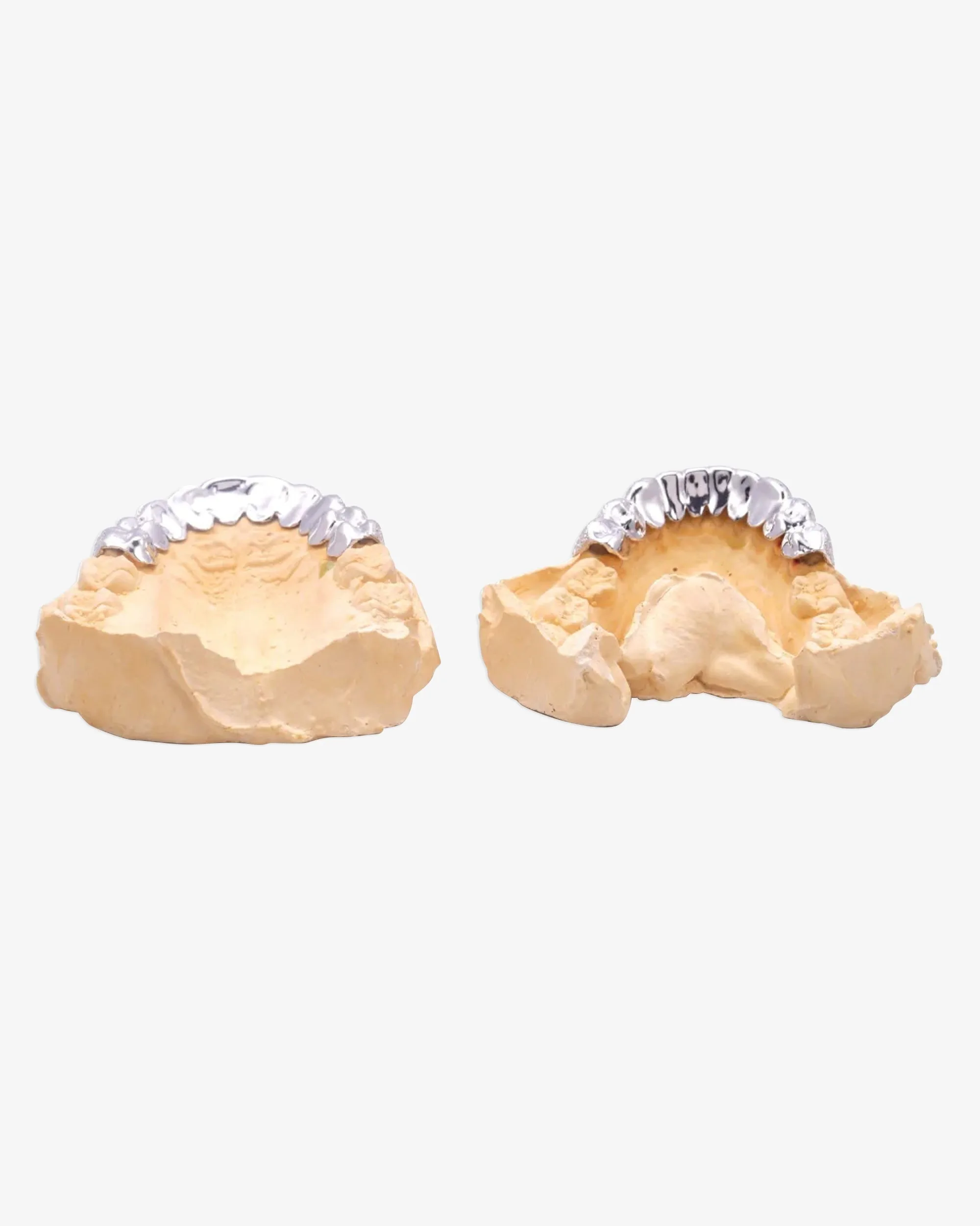 10 on 10 VVS Moissanite Prong Diamond Grillz - in white gold (view 7 of 24)