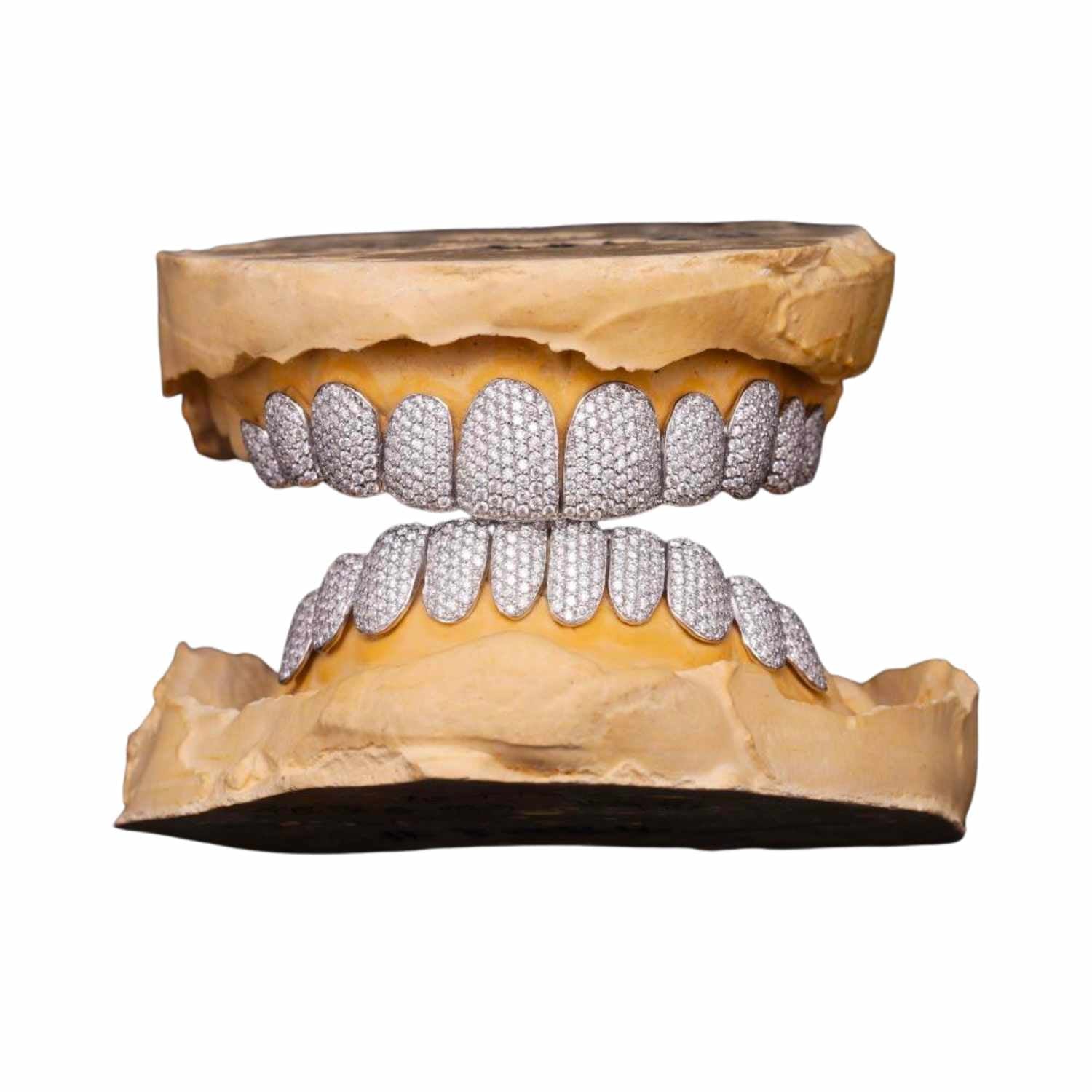 10 on 10 VVS Moissanite Prong Diamond Grillz - in white gold (view 9 of 24)