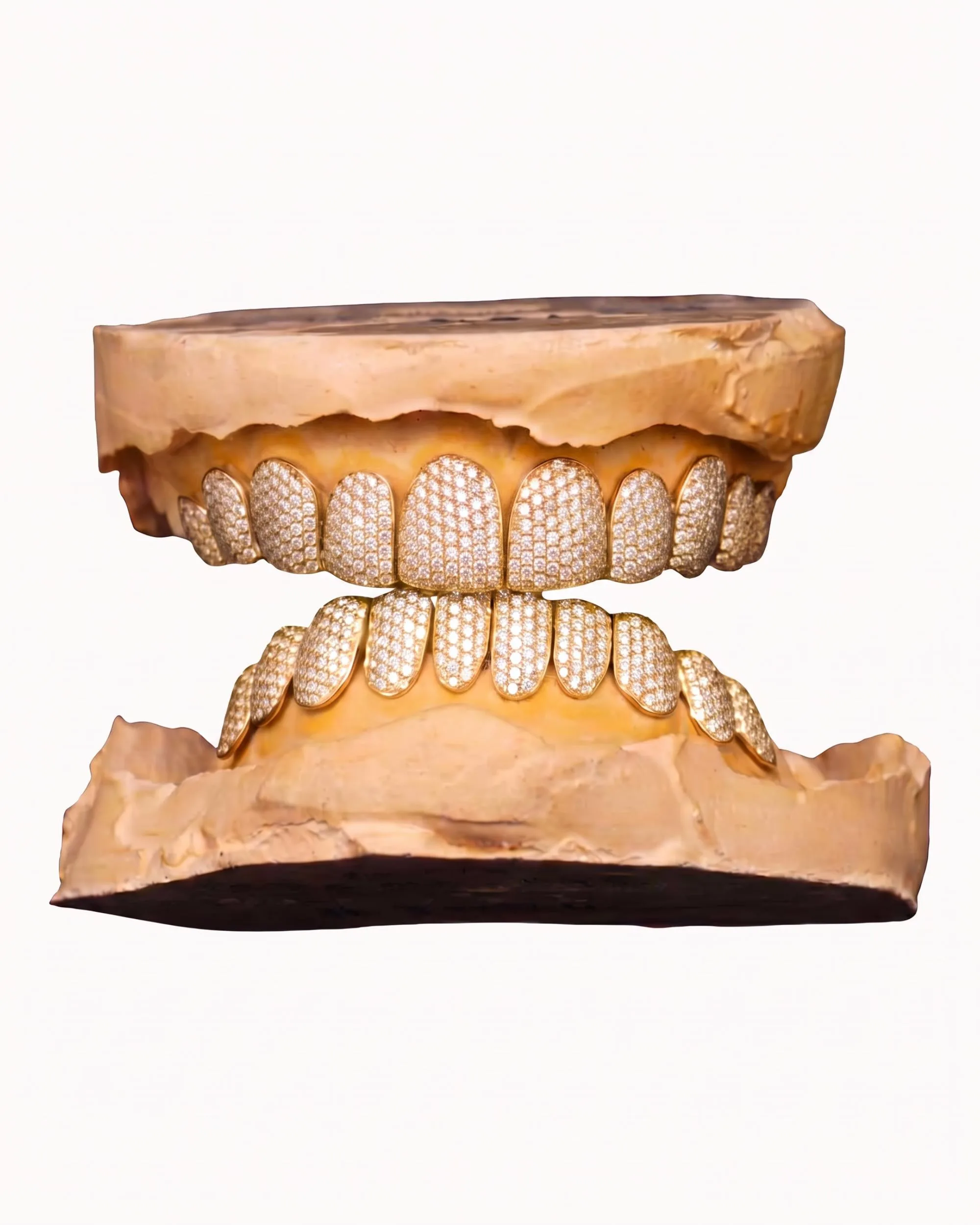 10 on 10 VVS Moissanite Prong Diamond Grillz - in white gold (view 17 of 24)