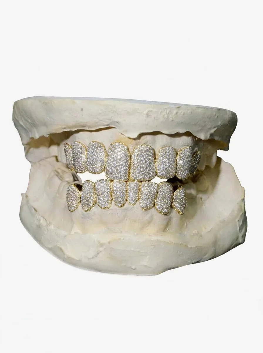 8 on 8 VVS Moissanite Diamond Grillz - in white gold (view 2 of 9)