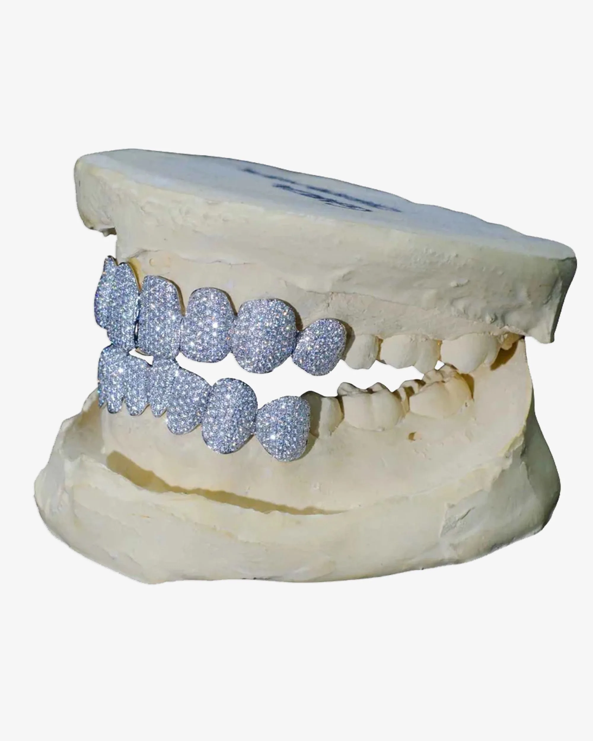8 on 8 VVS Moissanite Diamond Grillz - in white gold (view 7 of 9)
