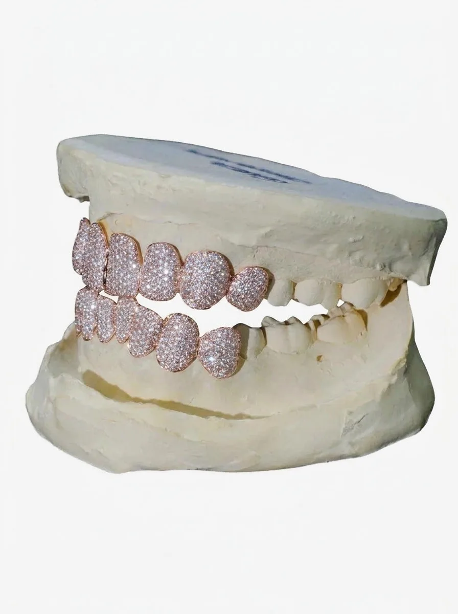 8 on 8 VVS Moissanite Diamond Grillz - in white gold (view 8 of 9)