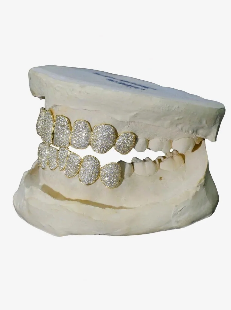 8 on 8 VVS Moissanite Diamond Grillz - in white gold (view 9 of 9)