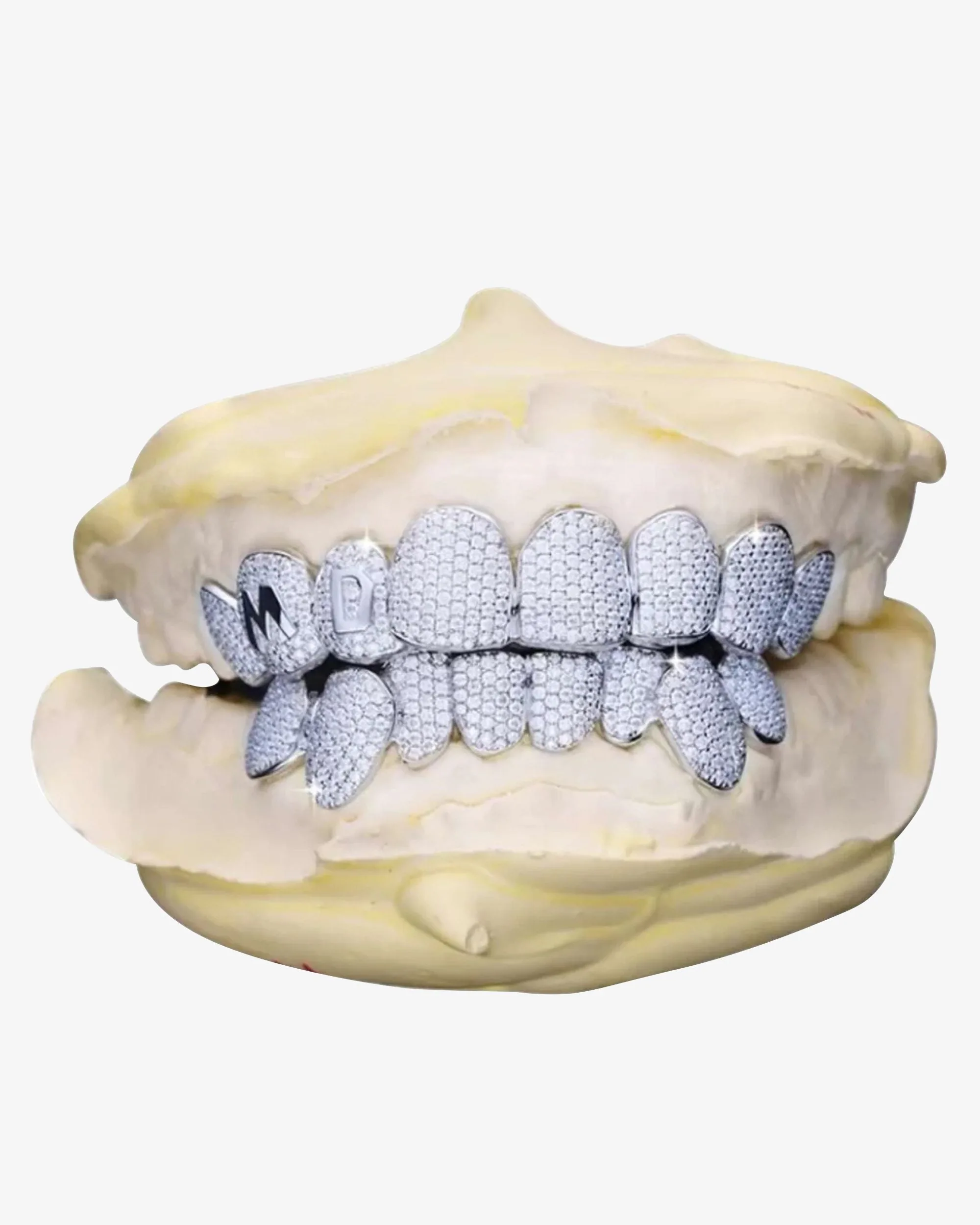 Custom Letter Moissanite Grillz - custom piece in white gold