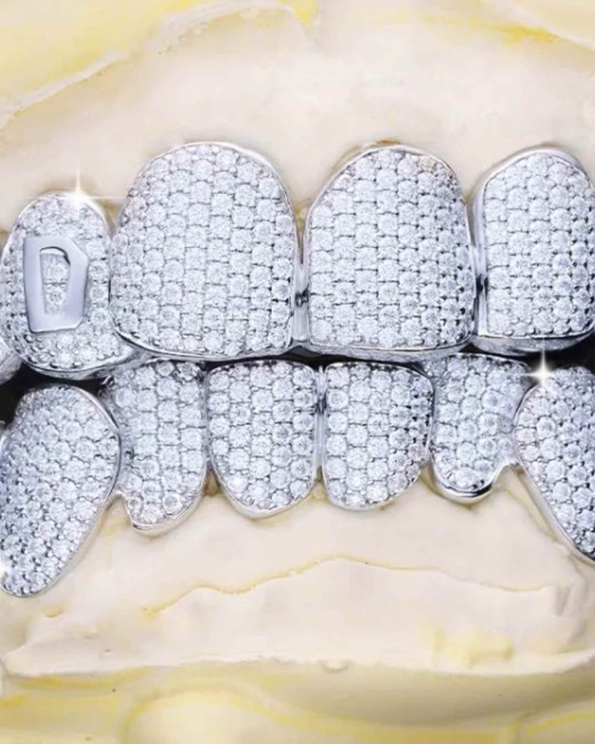 Custom Letter Moissanite Grillz - custom piece in white gold (view 3 of 15)