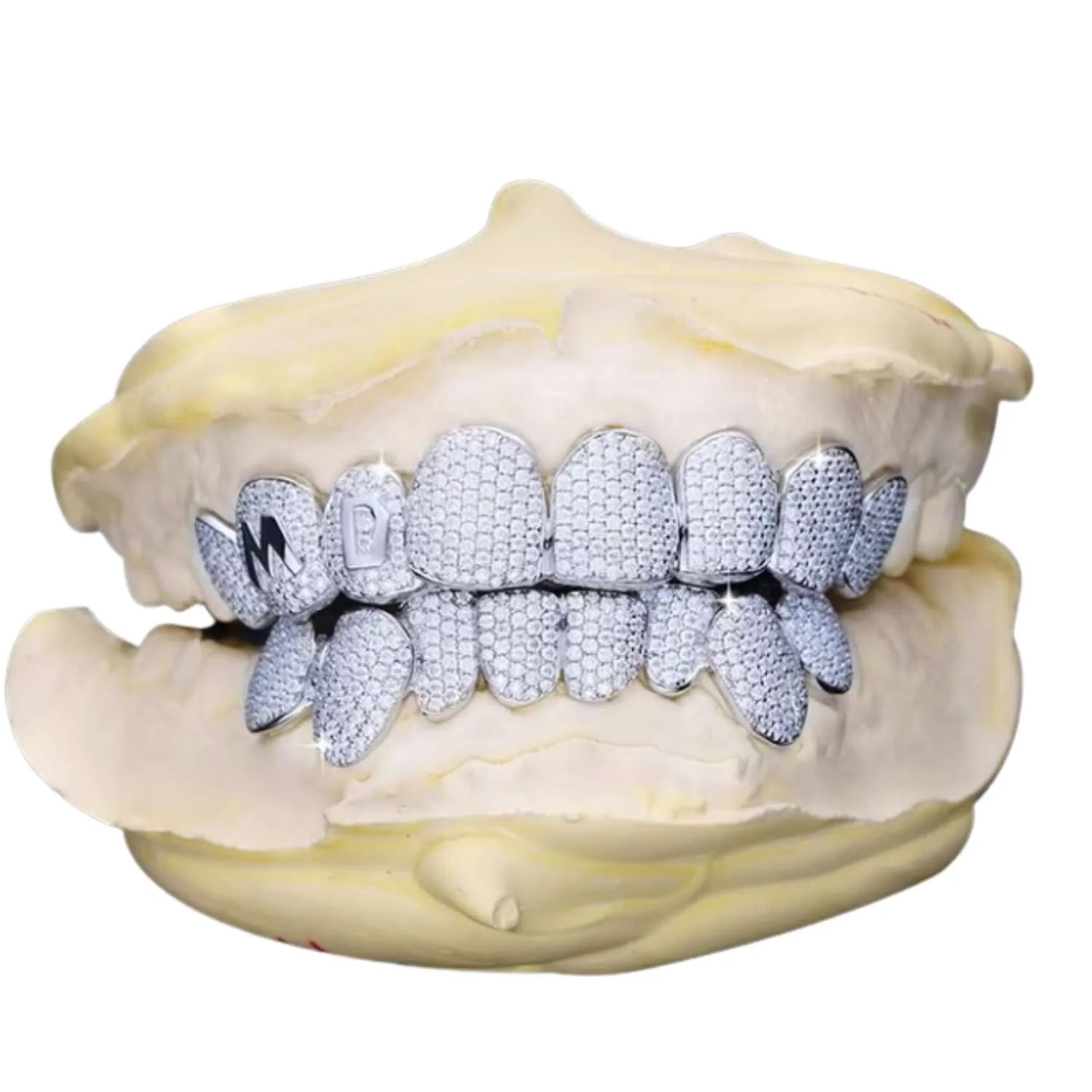 Custom Letter Moissanite Grillz - custom piece in white gold (view 5 of 15)