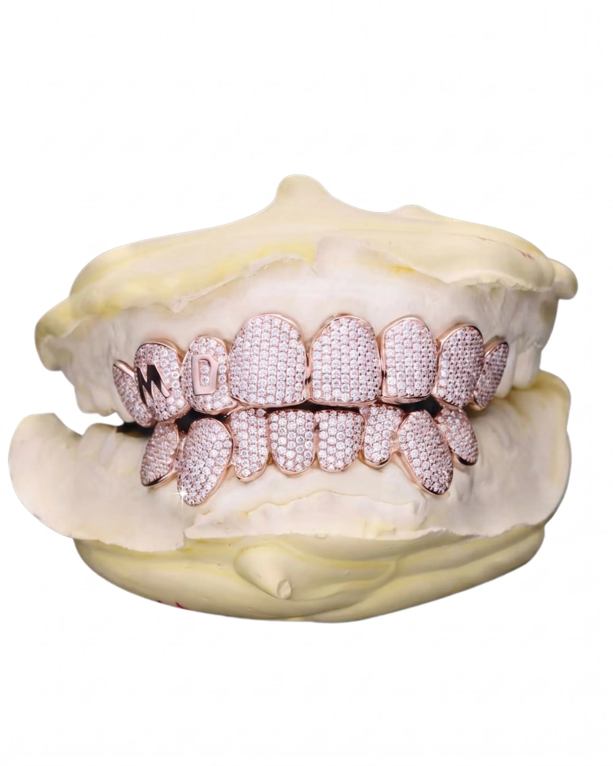 Custom Letter Moissanite Grillz - custom piece in white gold (view 6 of 15)