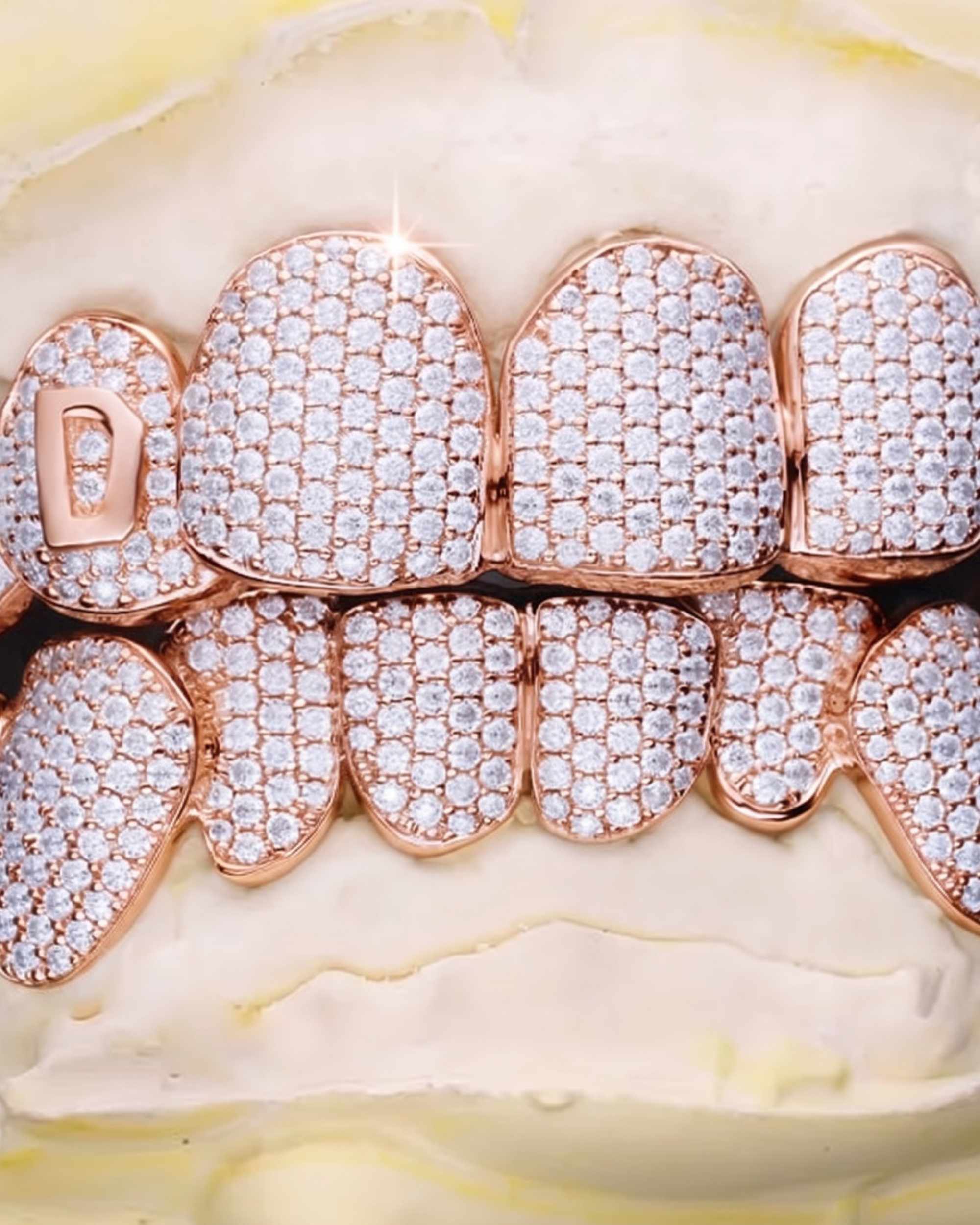 Custom Letter Moissanite Grillz - custom piece in white gold (view 8 of 15)