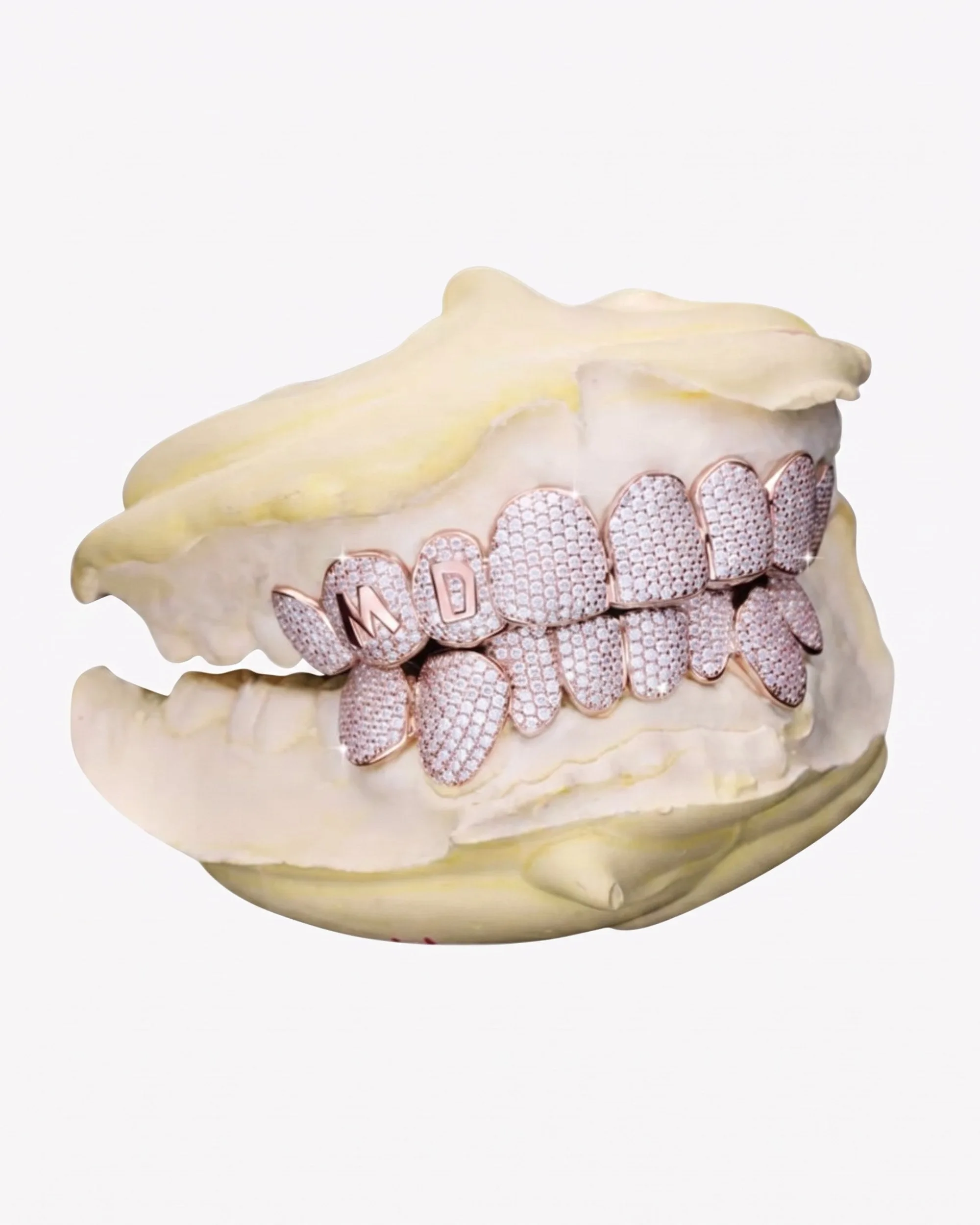 Custom Letter Moissanite Grillz - custom piece in white gold (view 9 of 15)