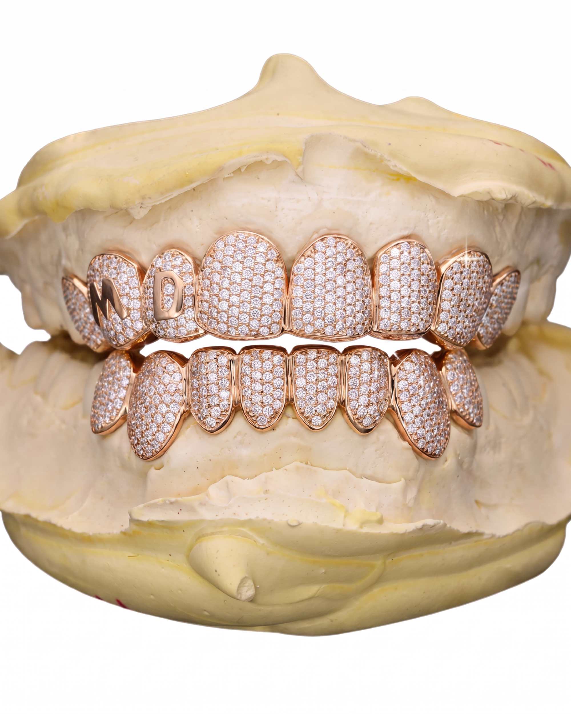 Custom Letter Moissanite Grillz - custom piece in white gold (view 10 of 15)