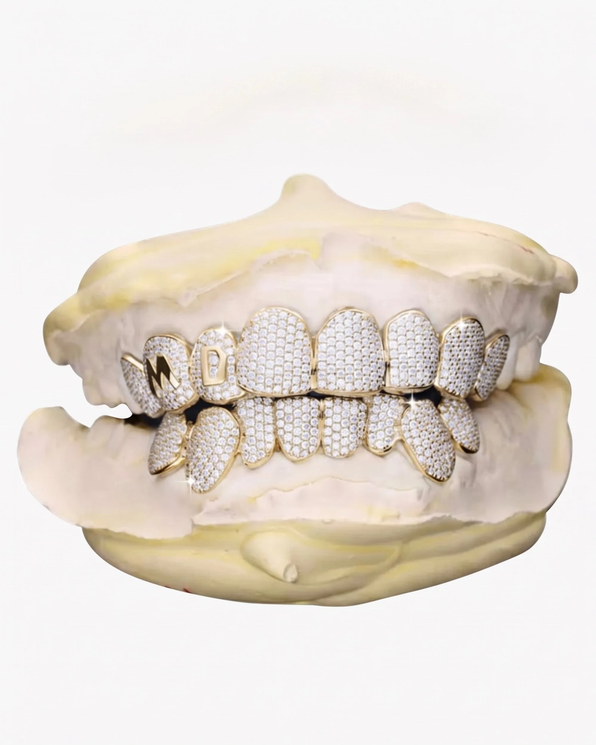 Custom Letter Moissanite Grillz - custom piece in white gold (view 11 of 15)