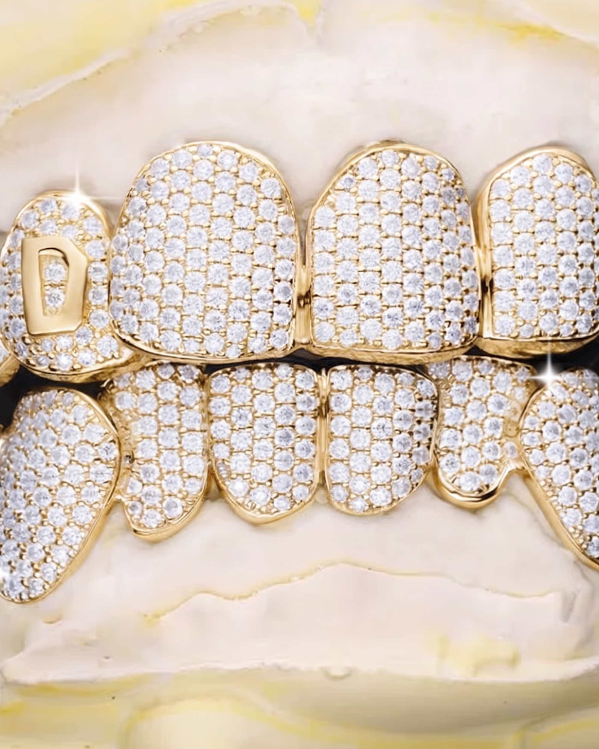 Custom Letter Moissanite Grillz - custom piece in white gold (view 13 of 15)