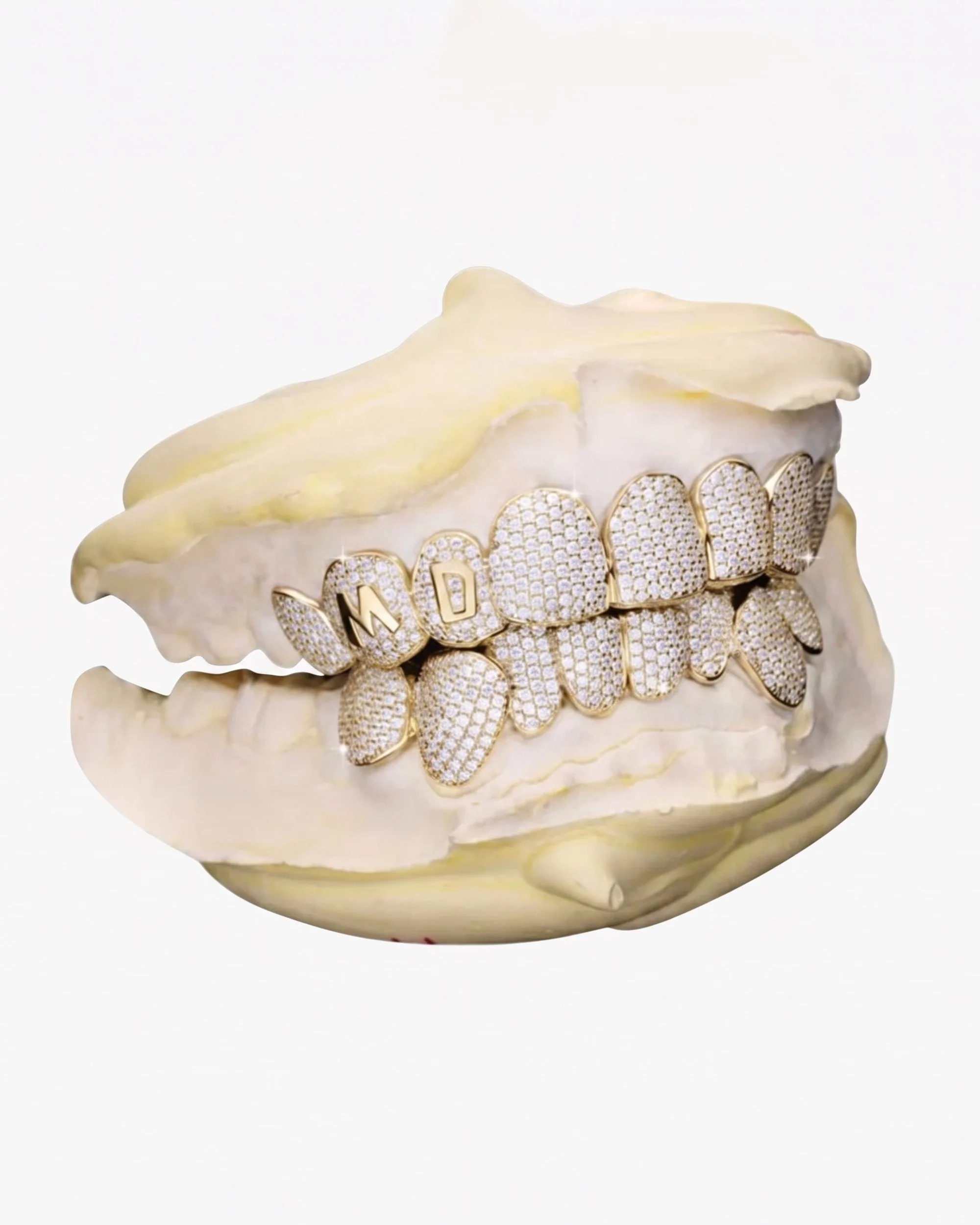 Custom Letter Moissanite Grillz - custom piece in white gold (view 14 of 15)