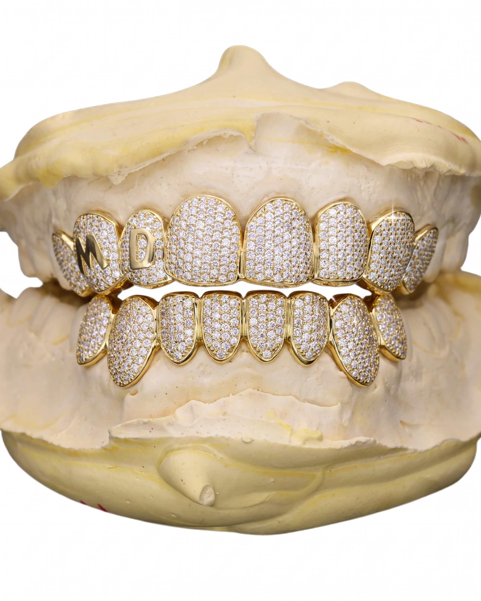 Custom Letter Moissanite Grillz - custom piece in white gold (view 15 of 15)
