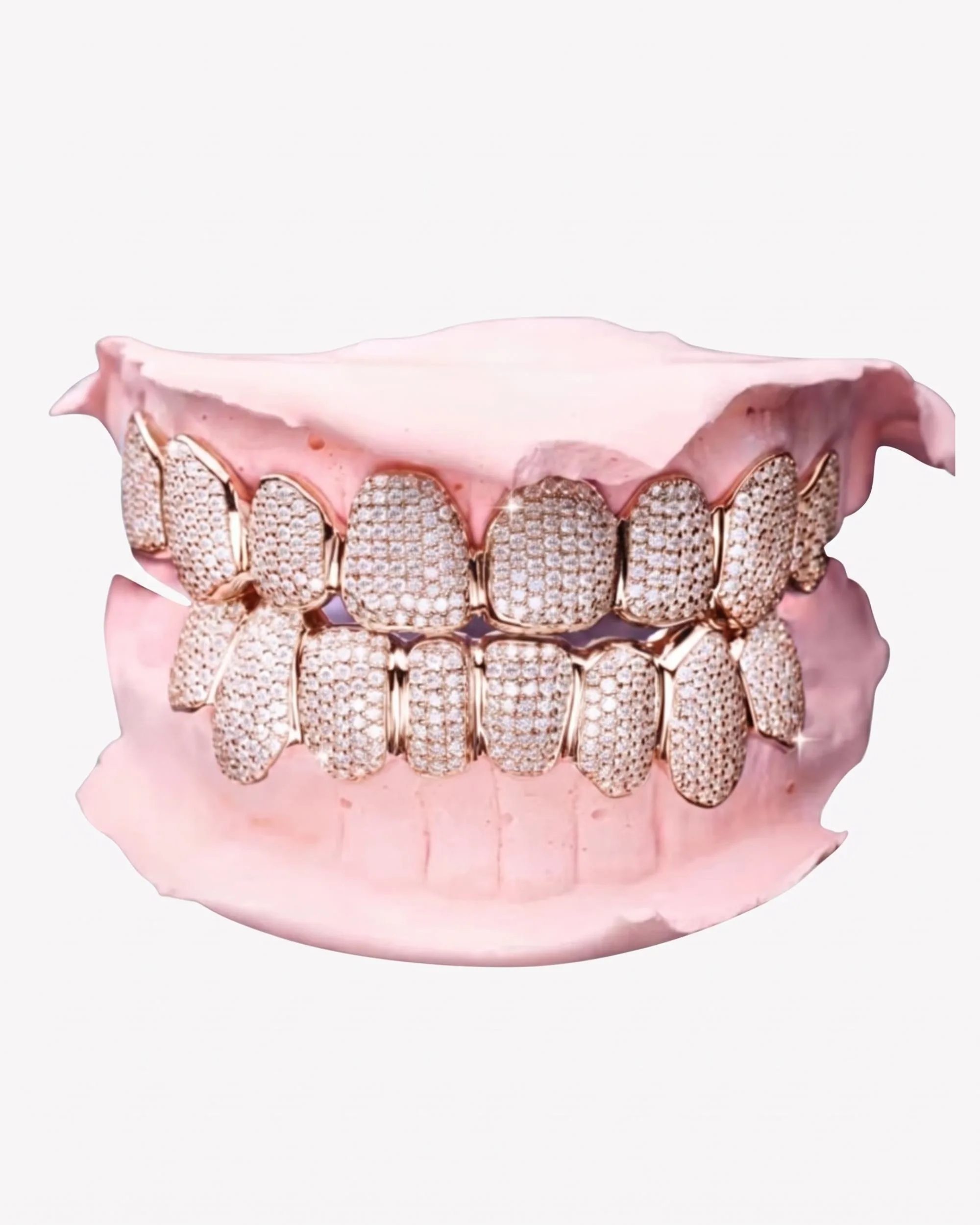 Custom Moissanite Cluster Grillz - custom piece in white gold (view 4 of 9)