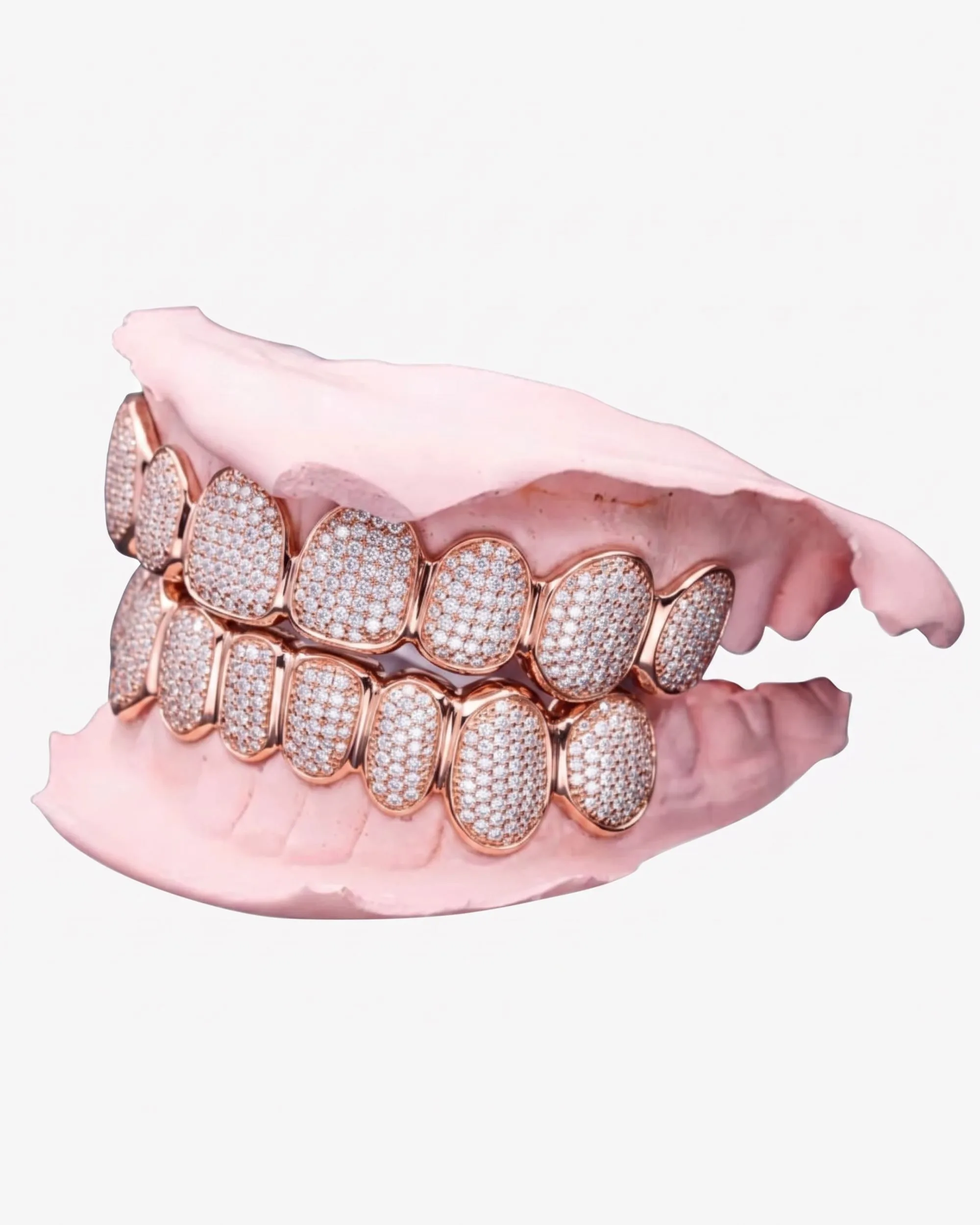 Custom Moissanite Cluster Grillz - custom piece in white gold (view 6 of 9)