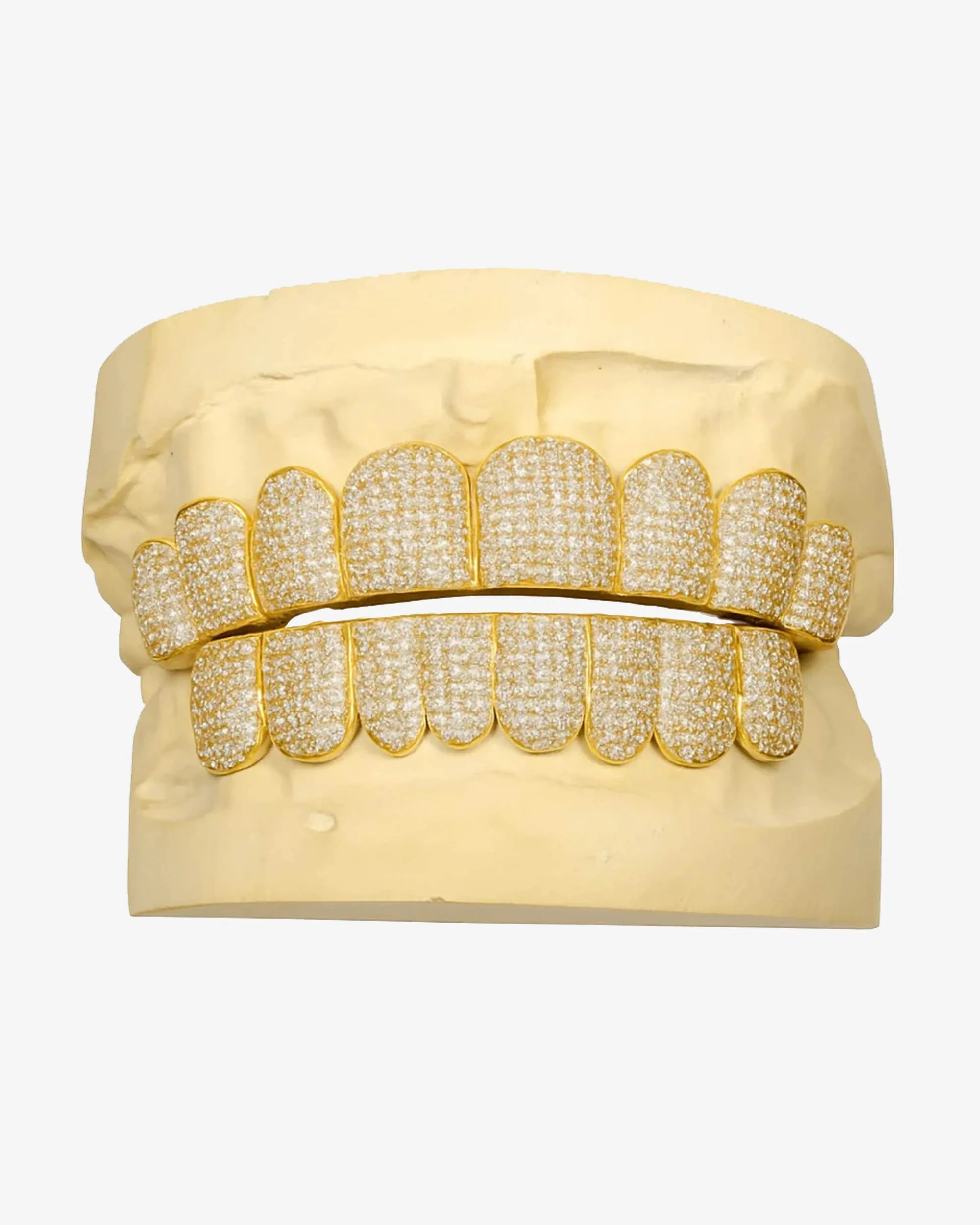 Custom Moissanite Diamond Grillz 14K Yellow Gold - custom piece