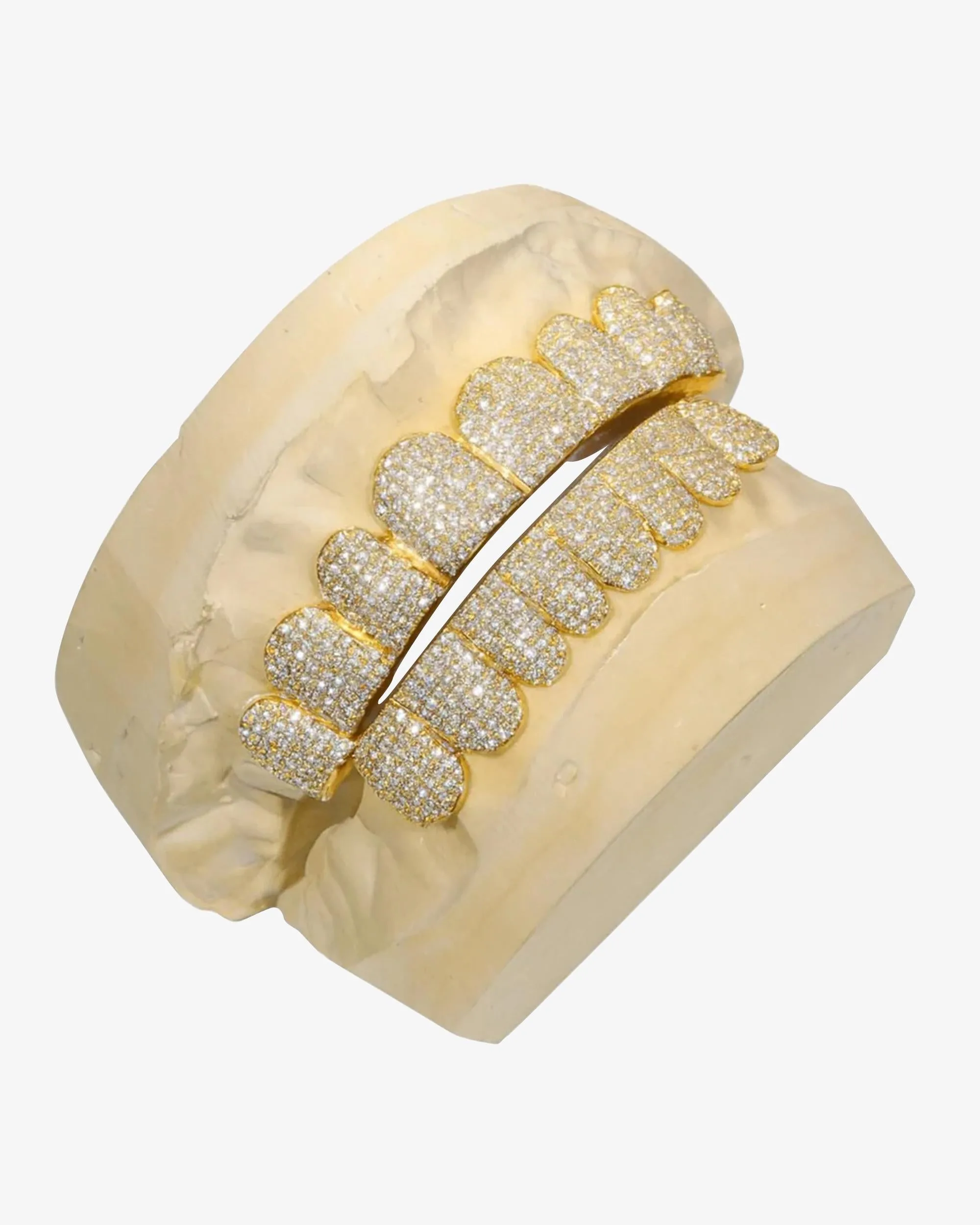 Custom Moissanite Diamond Grillz 14K Yellow Gold - custom piece (view 3 of 3)
