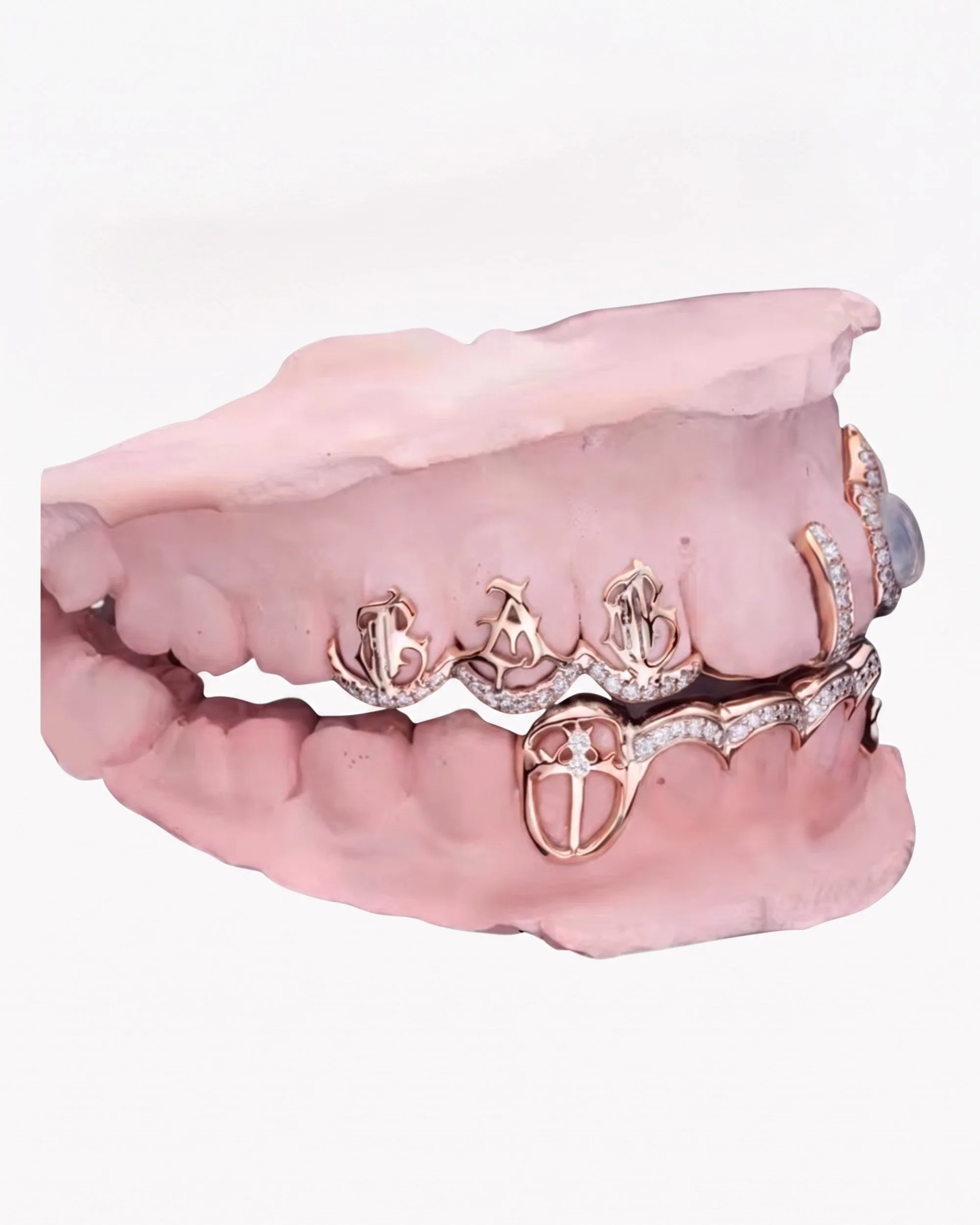 Custom Moissanite Opal Grillz - custom piece in white gold (view 7 of 12)