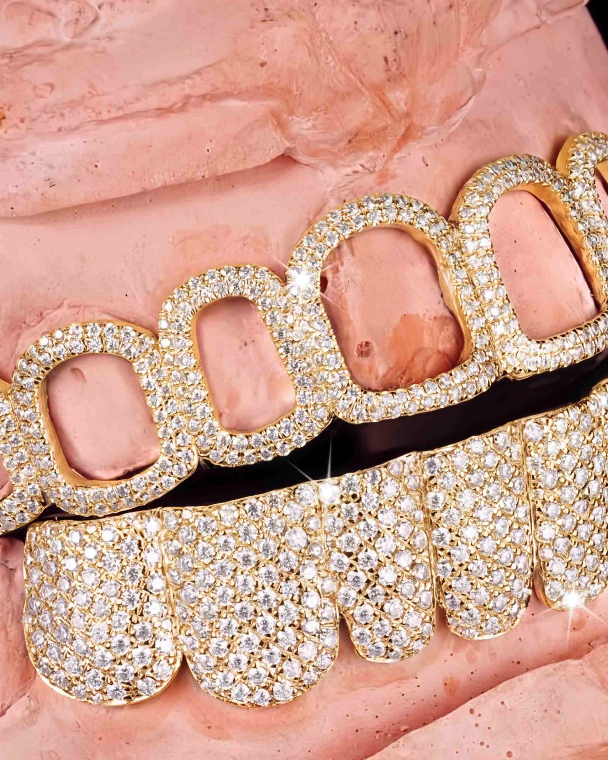 Open Face Moissanite Grillz - in white gold (view 6 of 9)