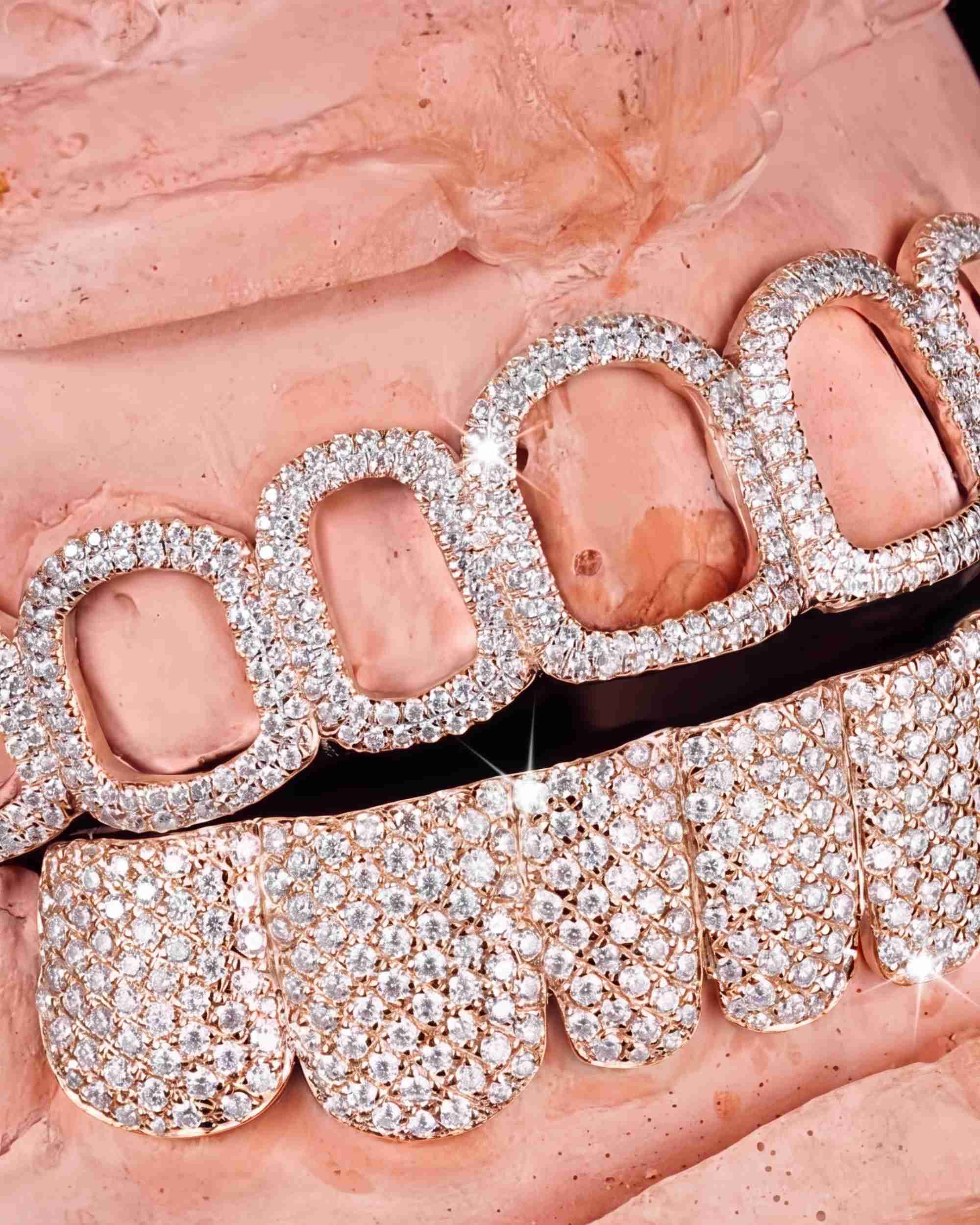 Open Face Moissanite Grillz - in white gold (view 7 of 9)