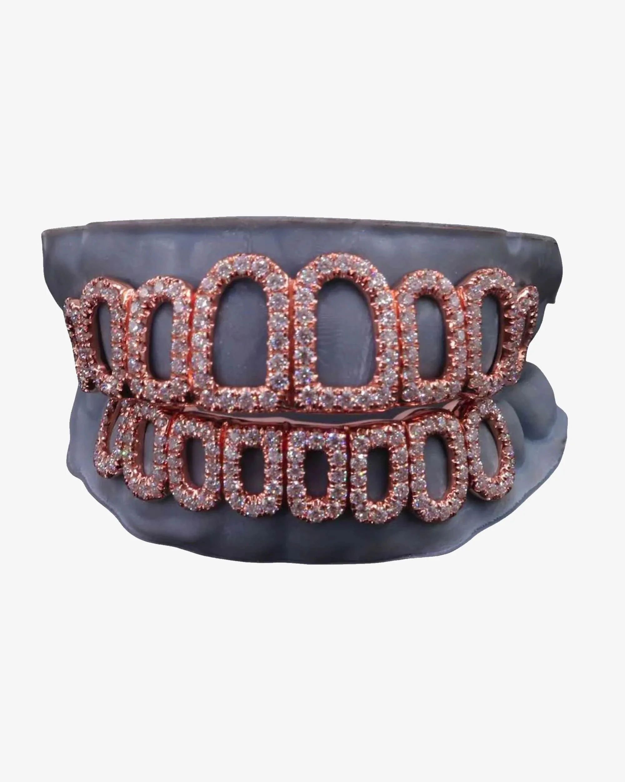 Rose Gold Open Face Custom Diamond Grillz - custom piece