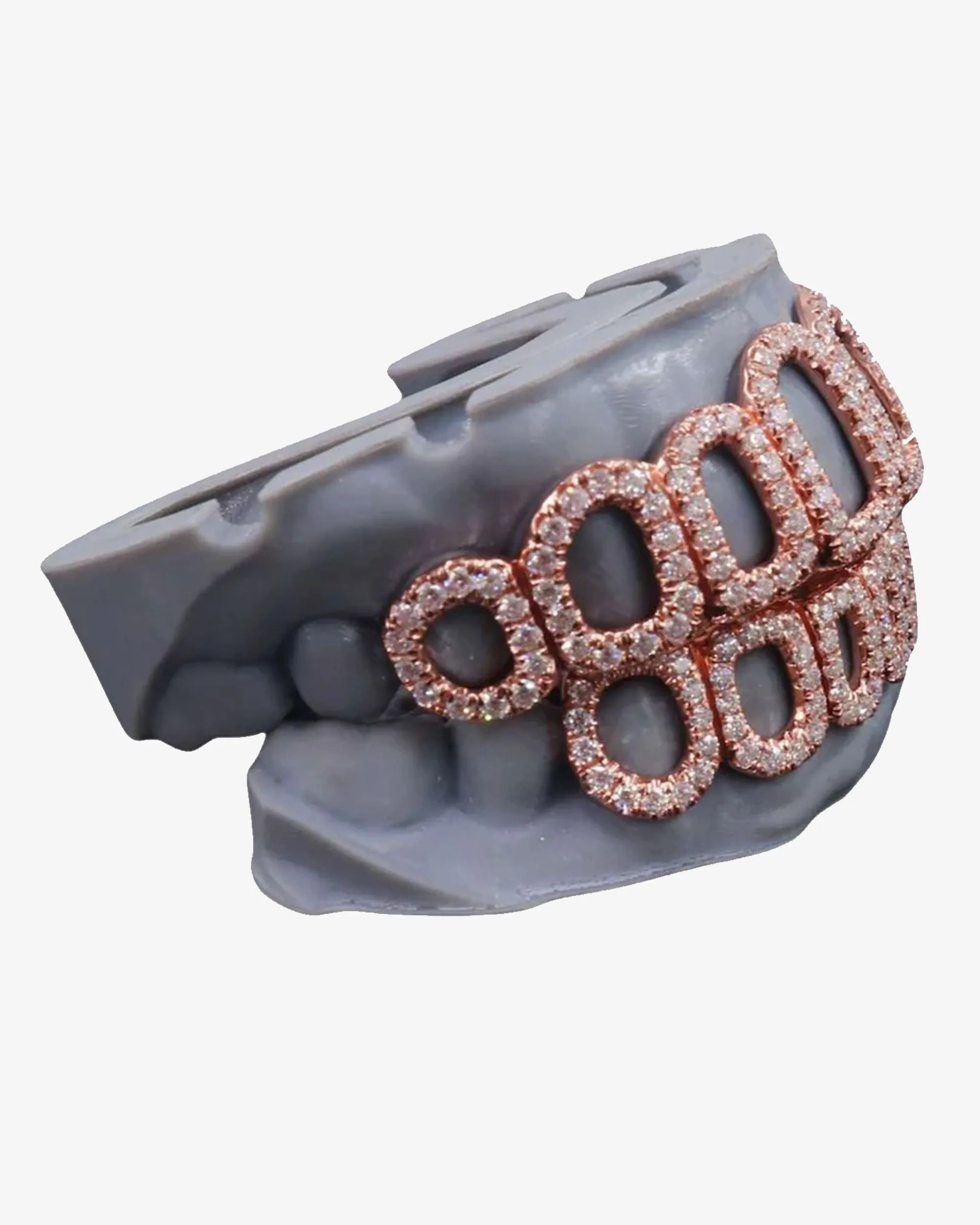 Rose Gold Open Face Custom Diamond Grillz - custom piece (view 3 of 9)