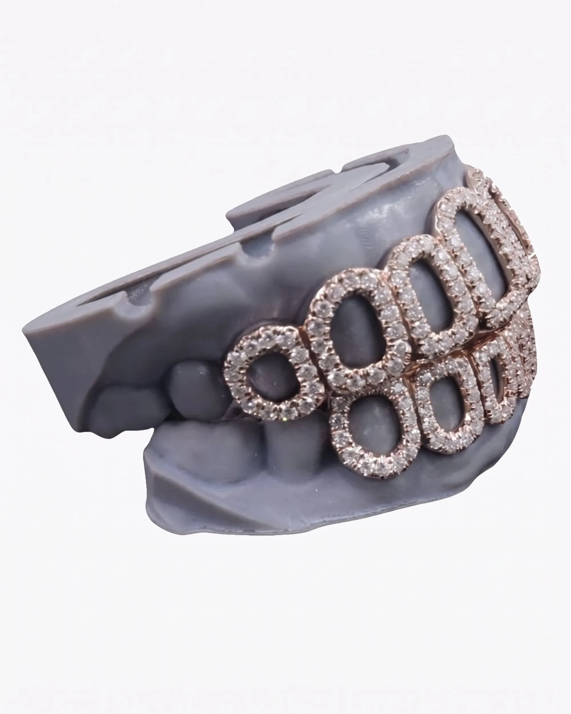 Rose Gold Open Face Custom Diamond Grillz - custom piece (view 5 of 9)