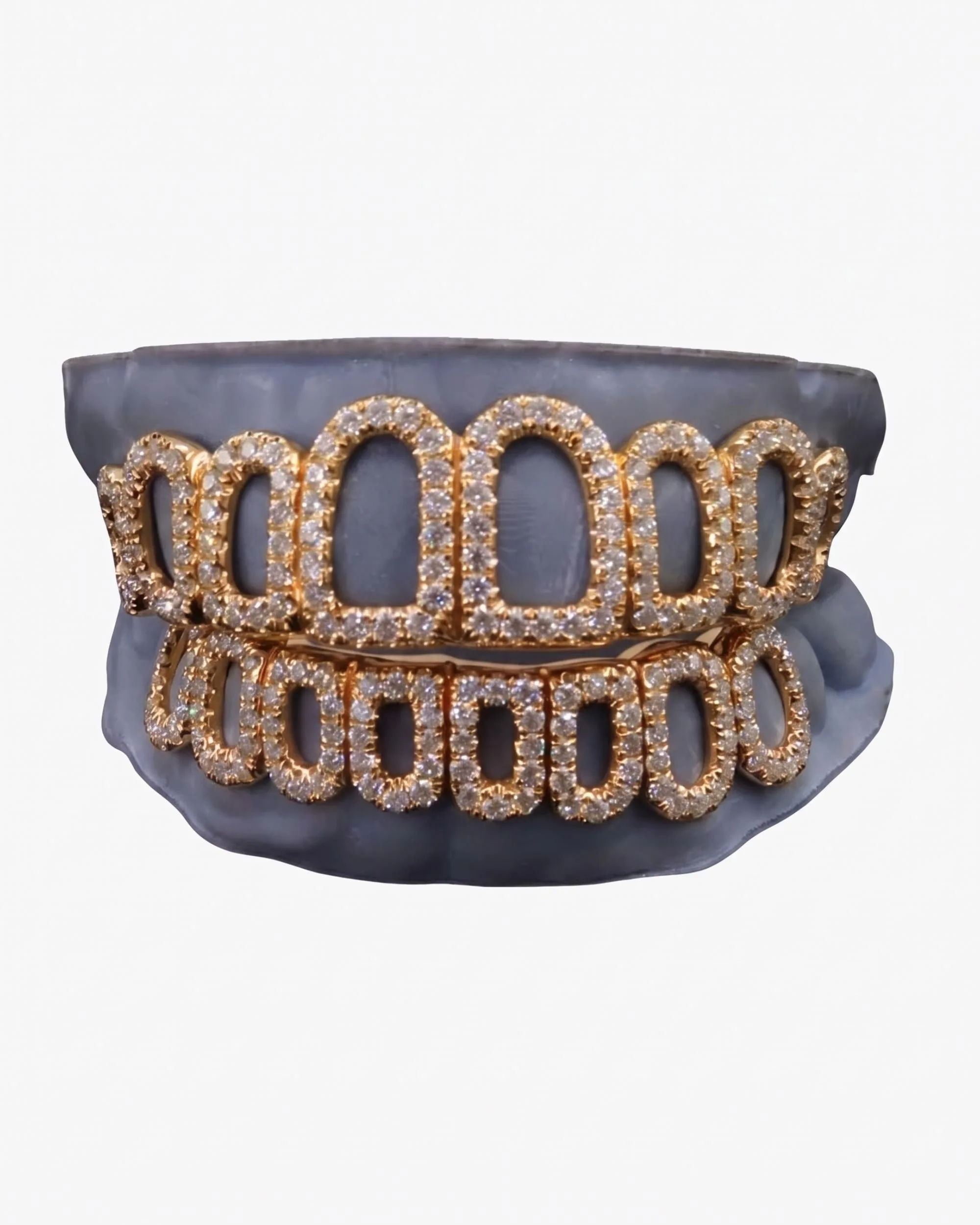 Rose Gold Open Face Custom Diamond Grillz - custom piece (view 7 of 9)