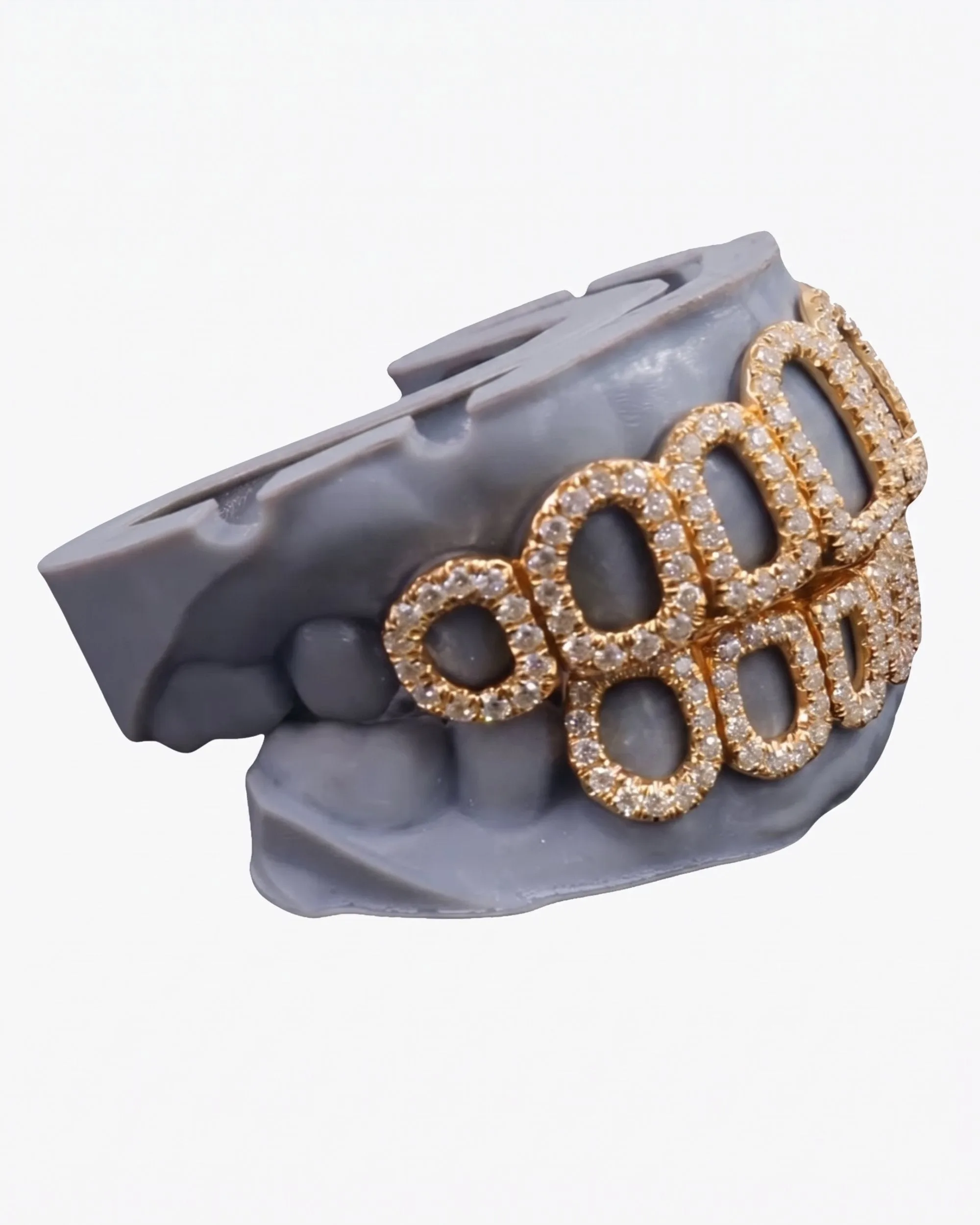 Rose Gold Open Face Custom Diamond Grillz - custom piece (view 9 of 9)