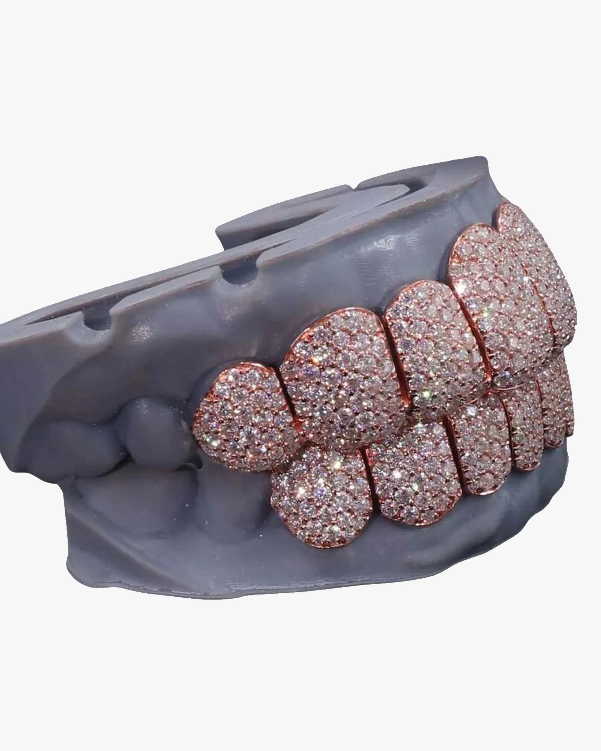 Rose Gold Perm Cut Custom Diamond Grillz 14K Gold - custom piece (view 3 of 9)