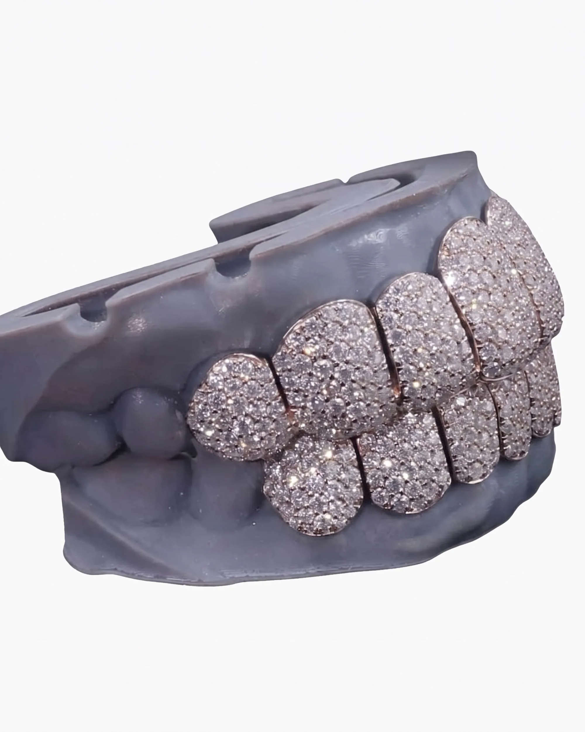 Rose Gold Perm Cut Custom Diamond Grillz 14K Gold - custom piece (view 6 of 9)